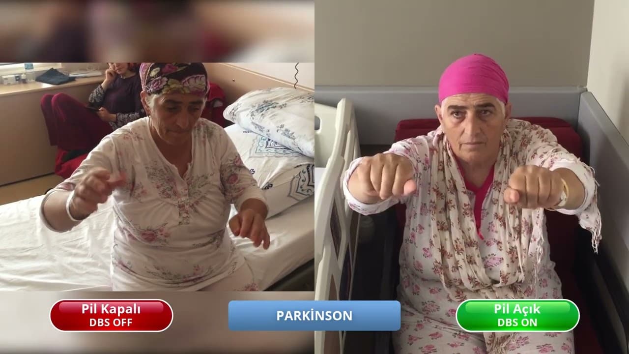 Ayşe — DBS On & Off