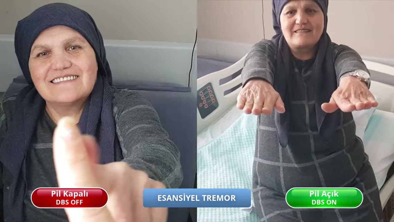 Ayten — Stimulator On & Off