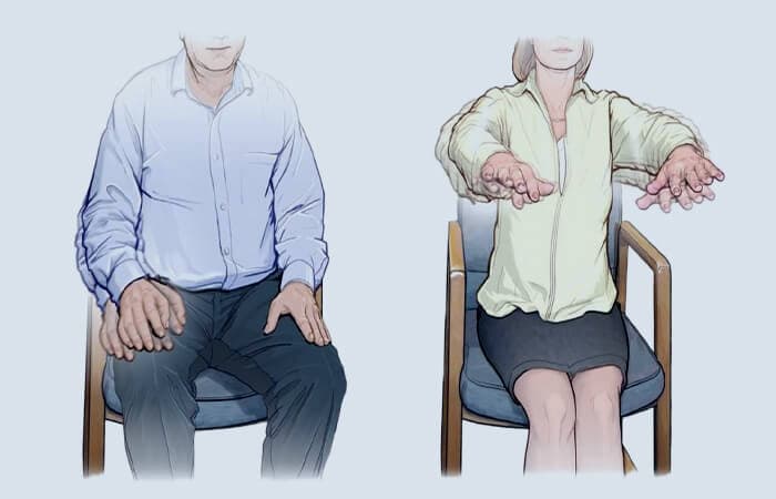 DBS in Essential Tremor